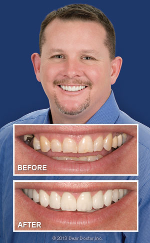 https://dentturkey.net/wp-content/uploads/2024/08/smile-makeover-before-and-after.jpg